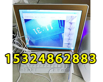 耳鼻喉檢測(cè)儀—電腦打印一體機(jī)